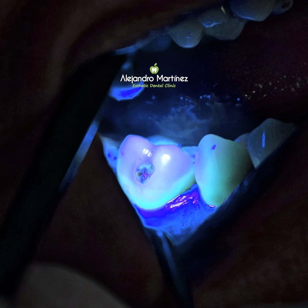 Alejandro Martinez-12