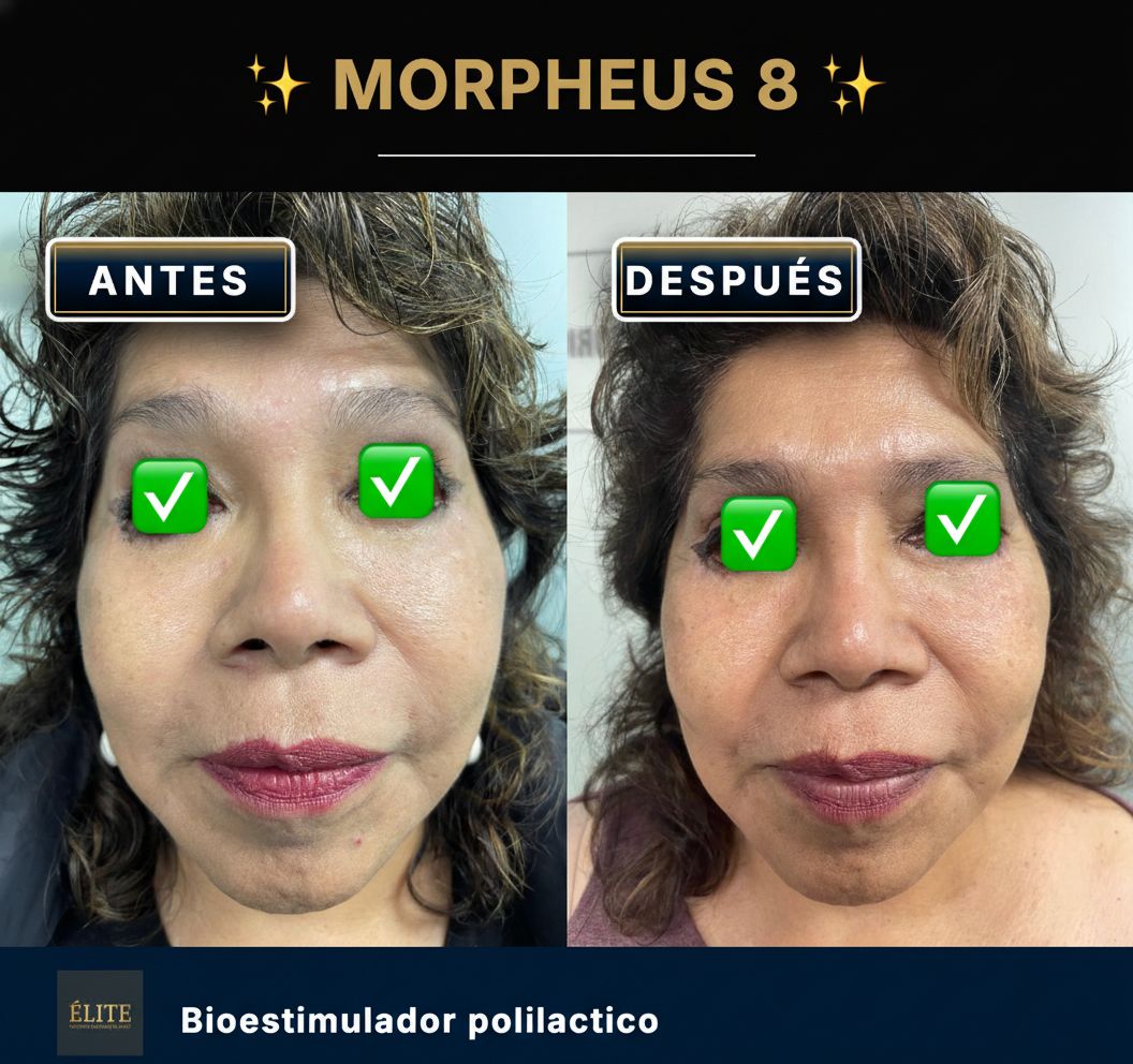 Roberto Alexander Rodriguez Zuñiga-3