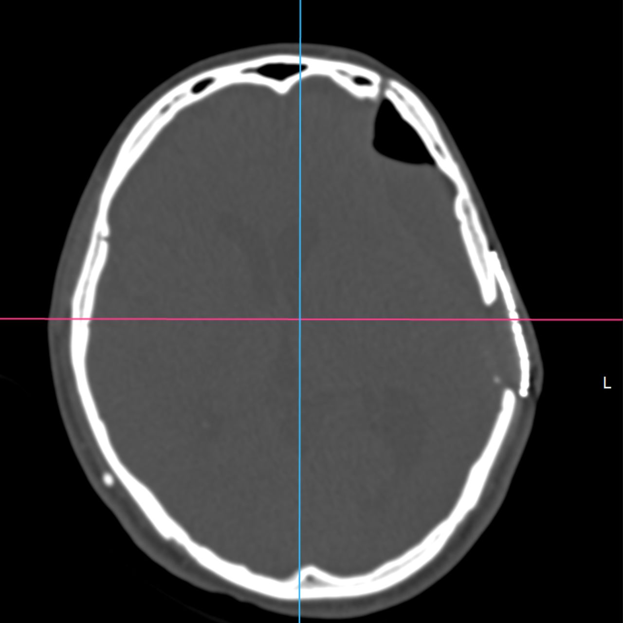 David Tafur Muñoz-2254