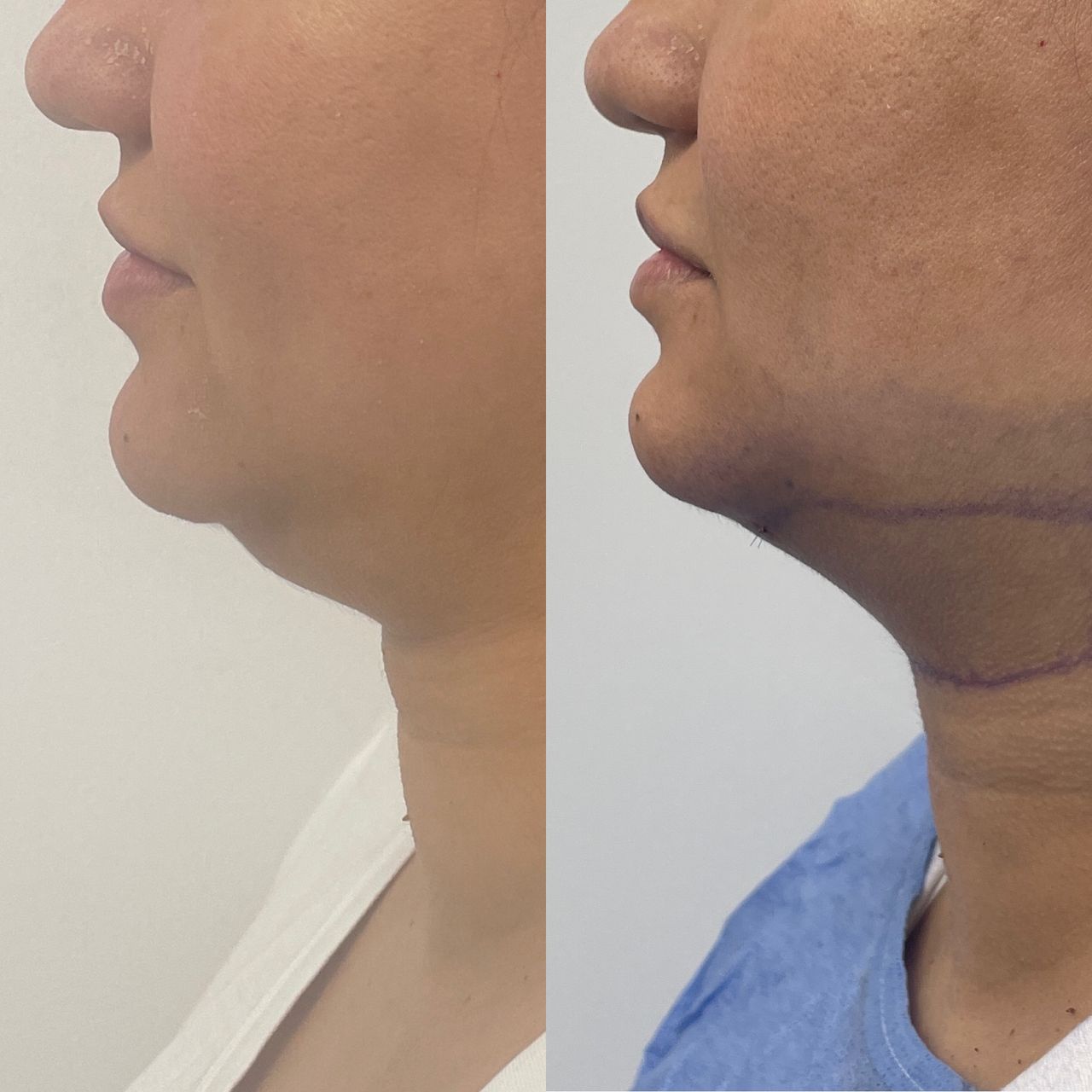 Jose Vicente Rocha Fernandez-33