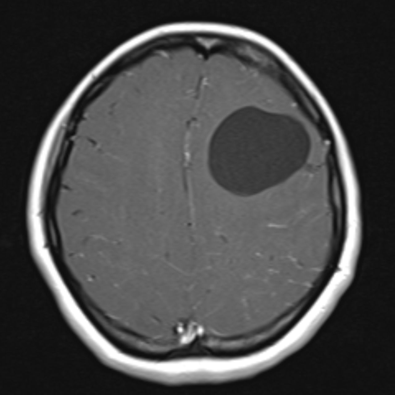 David Tafur Muñoz-2054