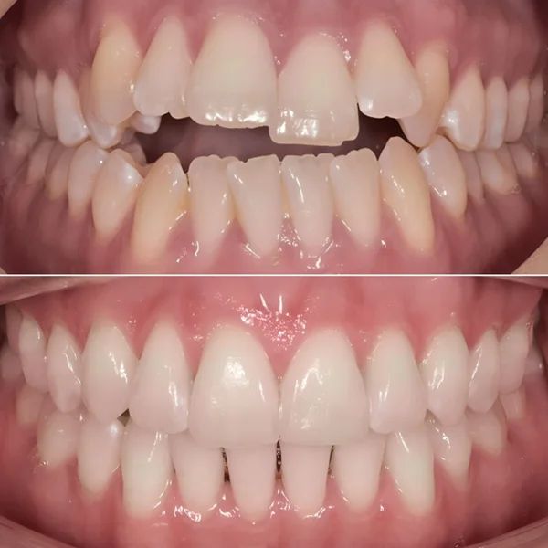 Frank Mendoza Alanya-28