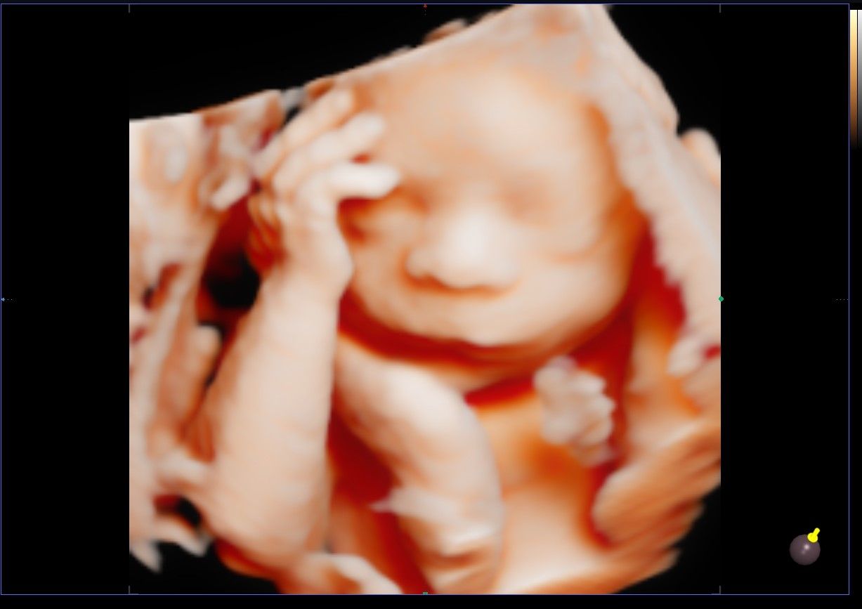 Mercy Yolima Martínez Velásquez-7