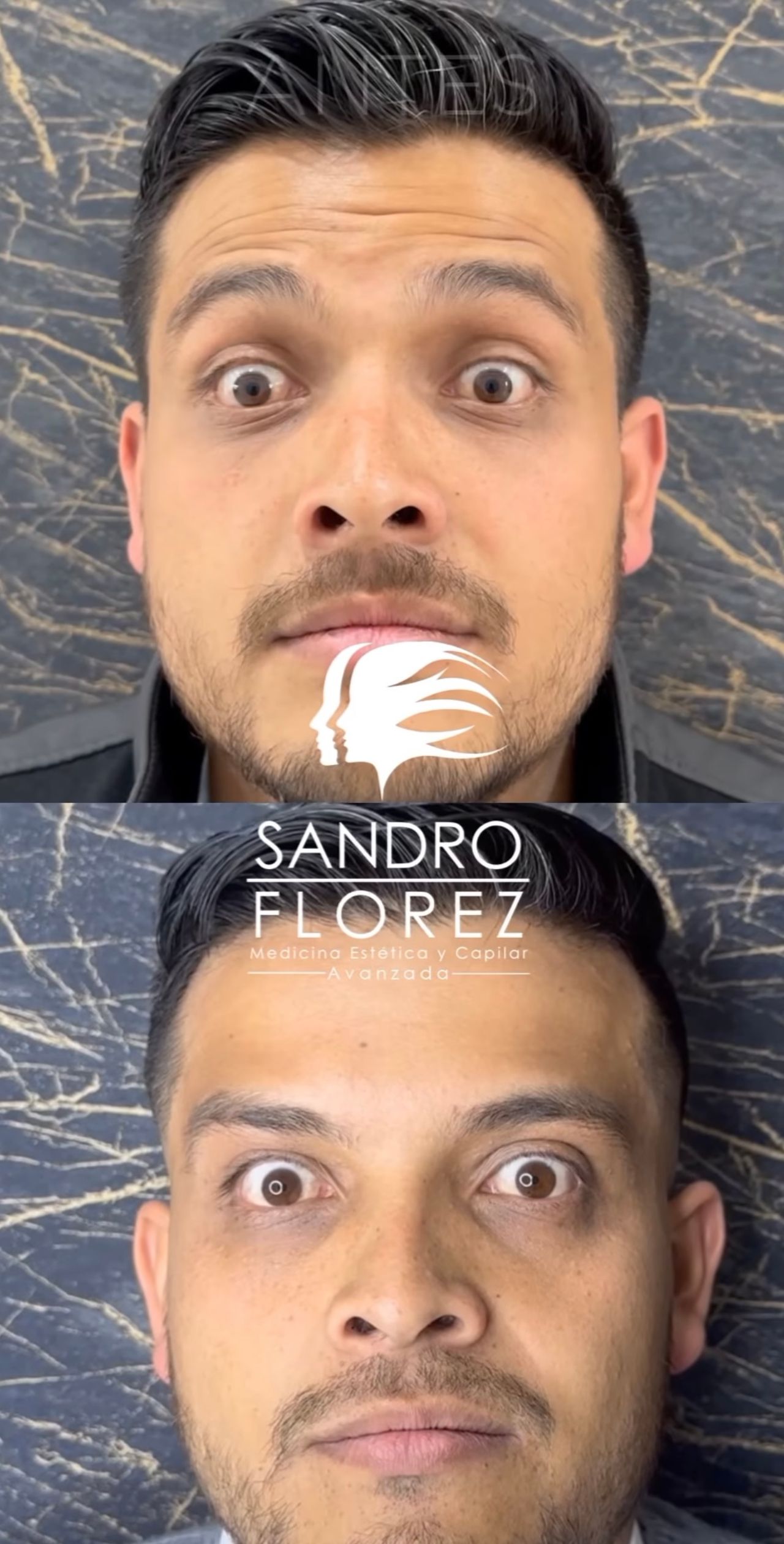 Sandro Florez-6