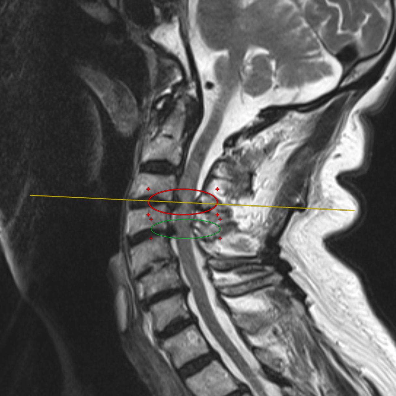 David Tafur Muñoz-1426