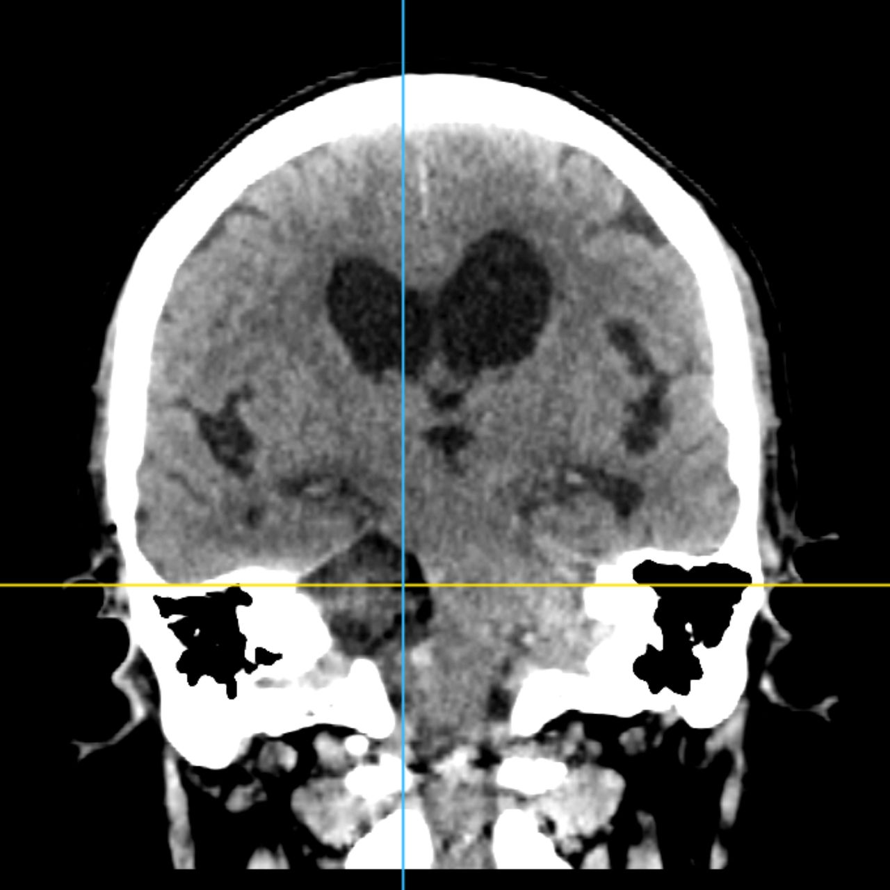 David Tafur Muñoz-2015