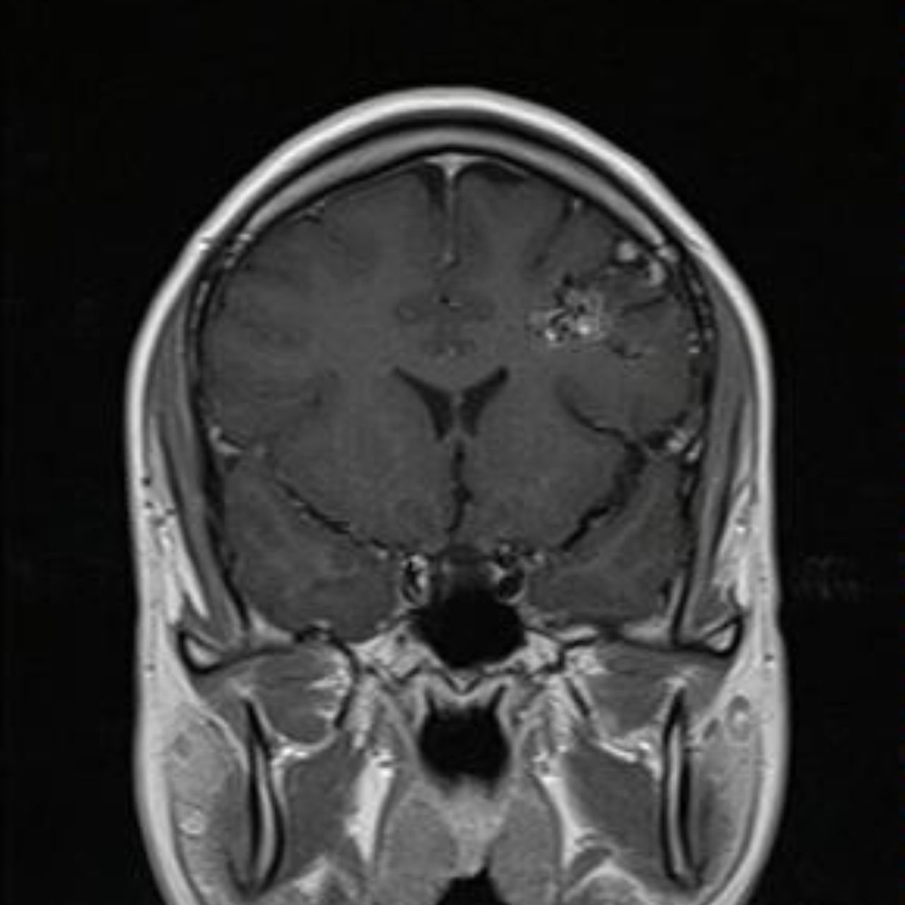 David Tafur Muñoz-1918