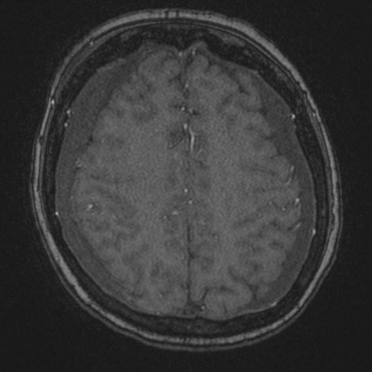 David Tafur Muñoz-1686