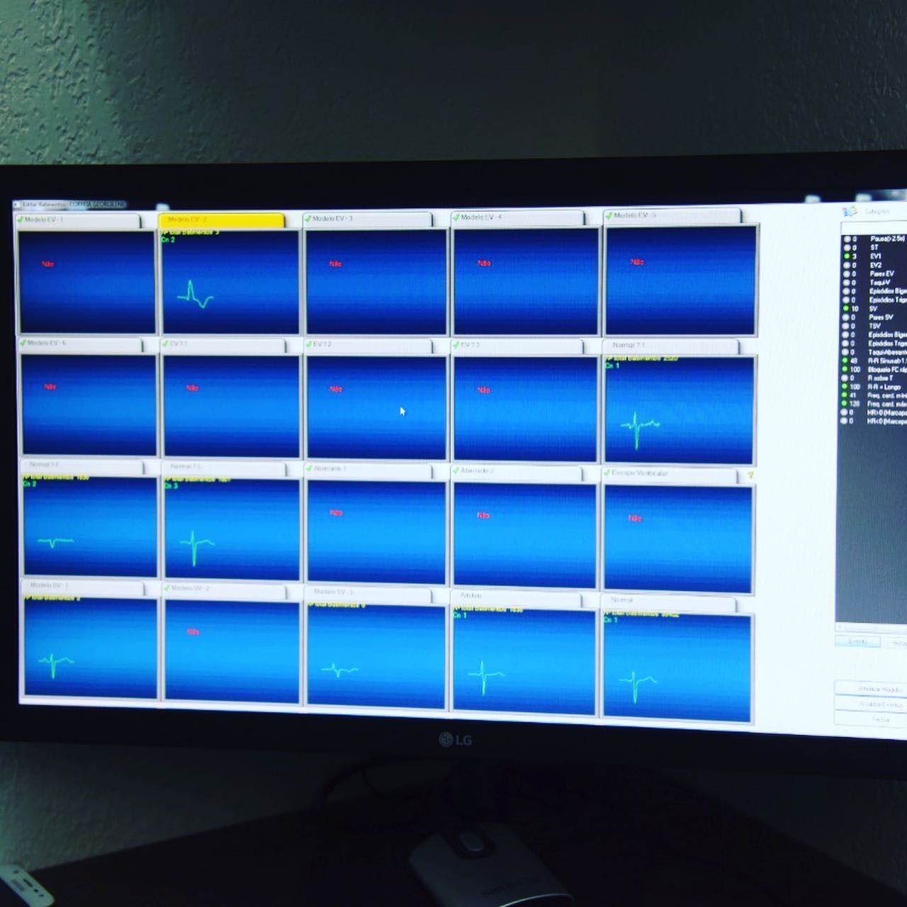 Solermo Camarão Barbosa Júnior-16