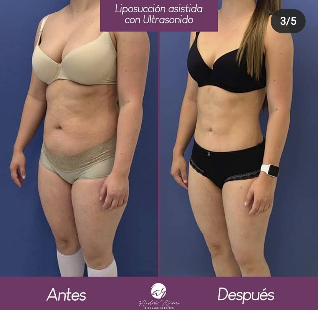 Andrés Rivera López-31