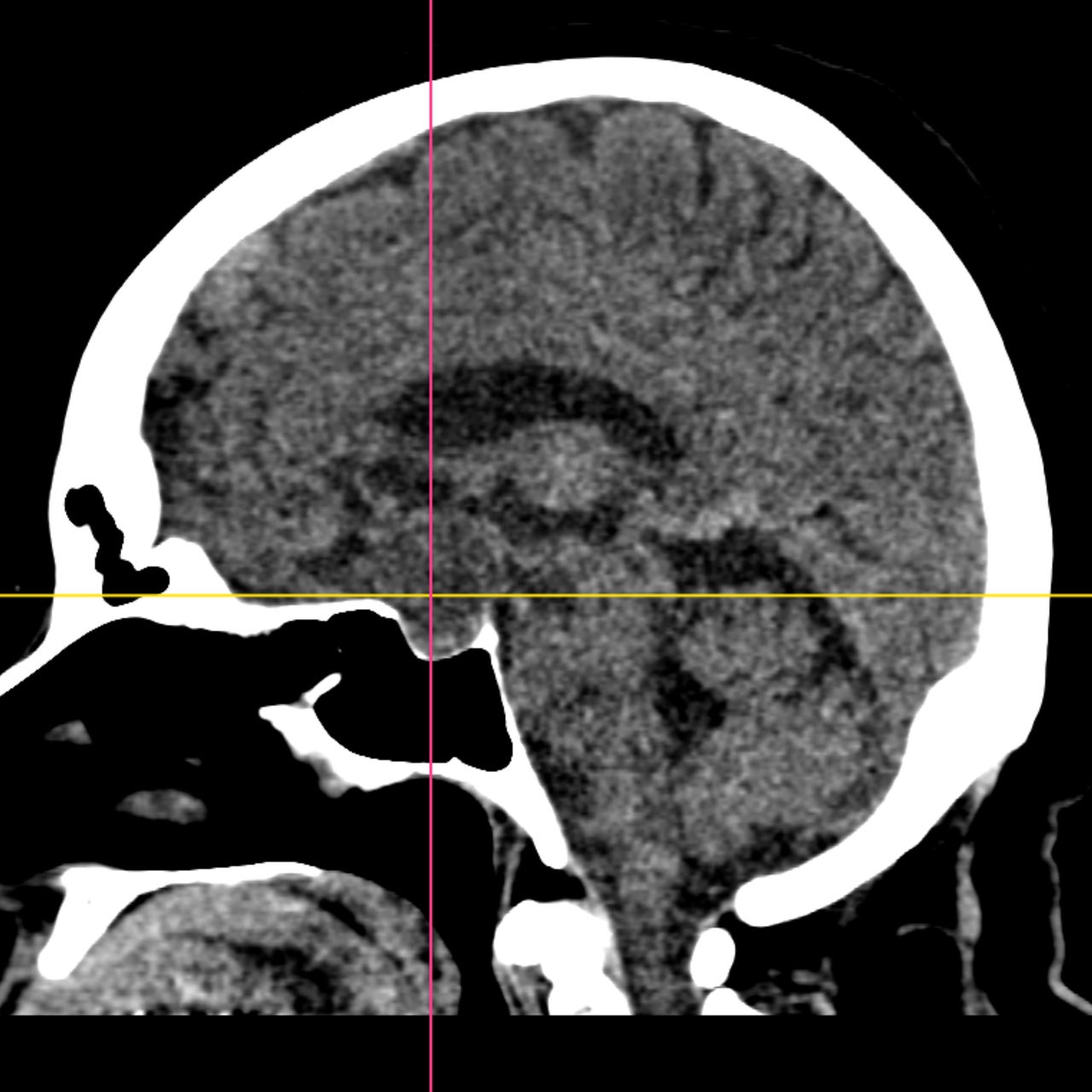 David Tafur Muñoz-1745