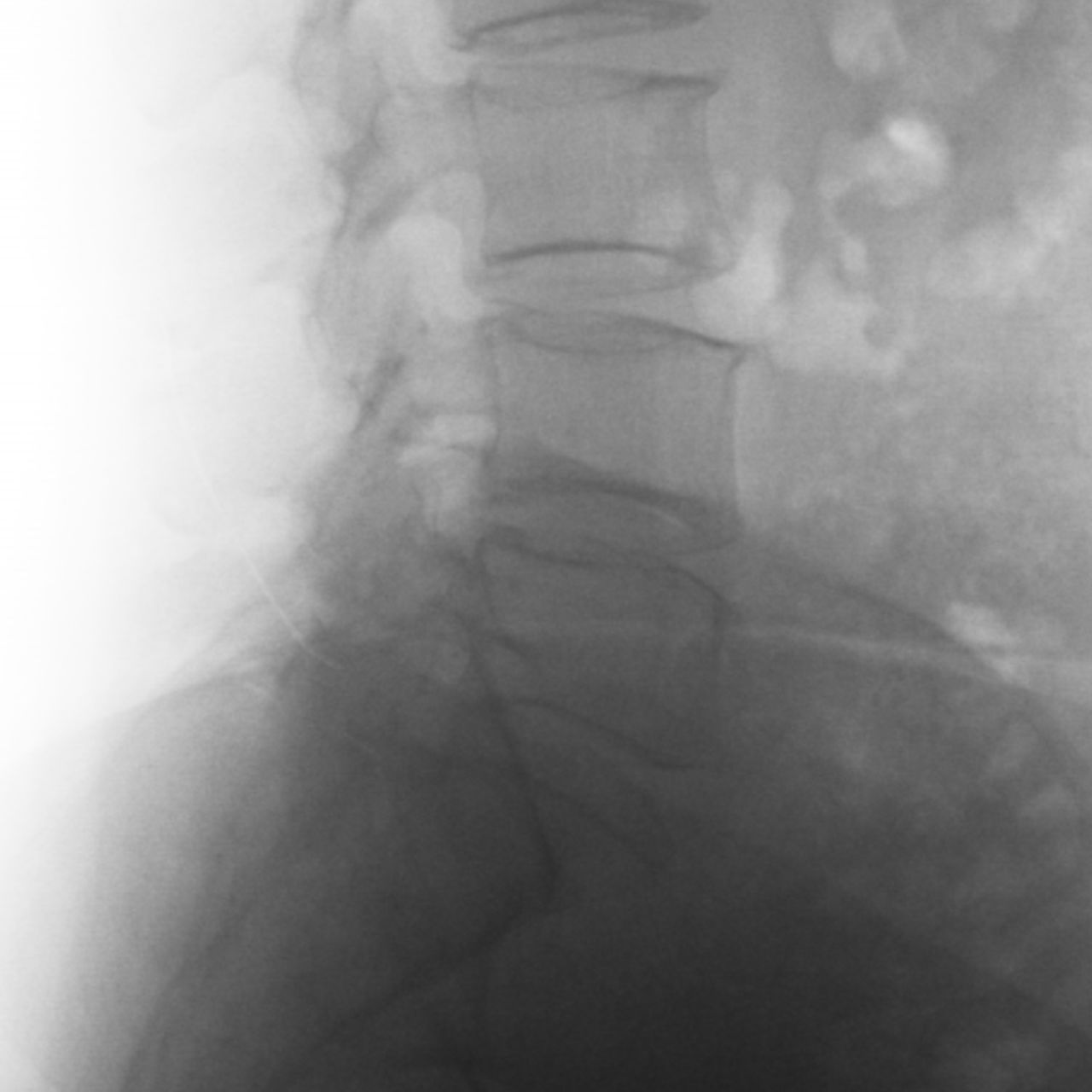 David Tafur Muñoz-1854