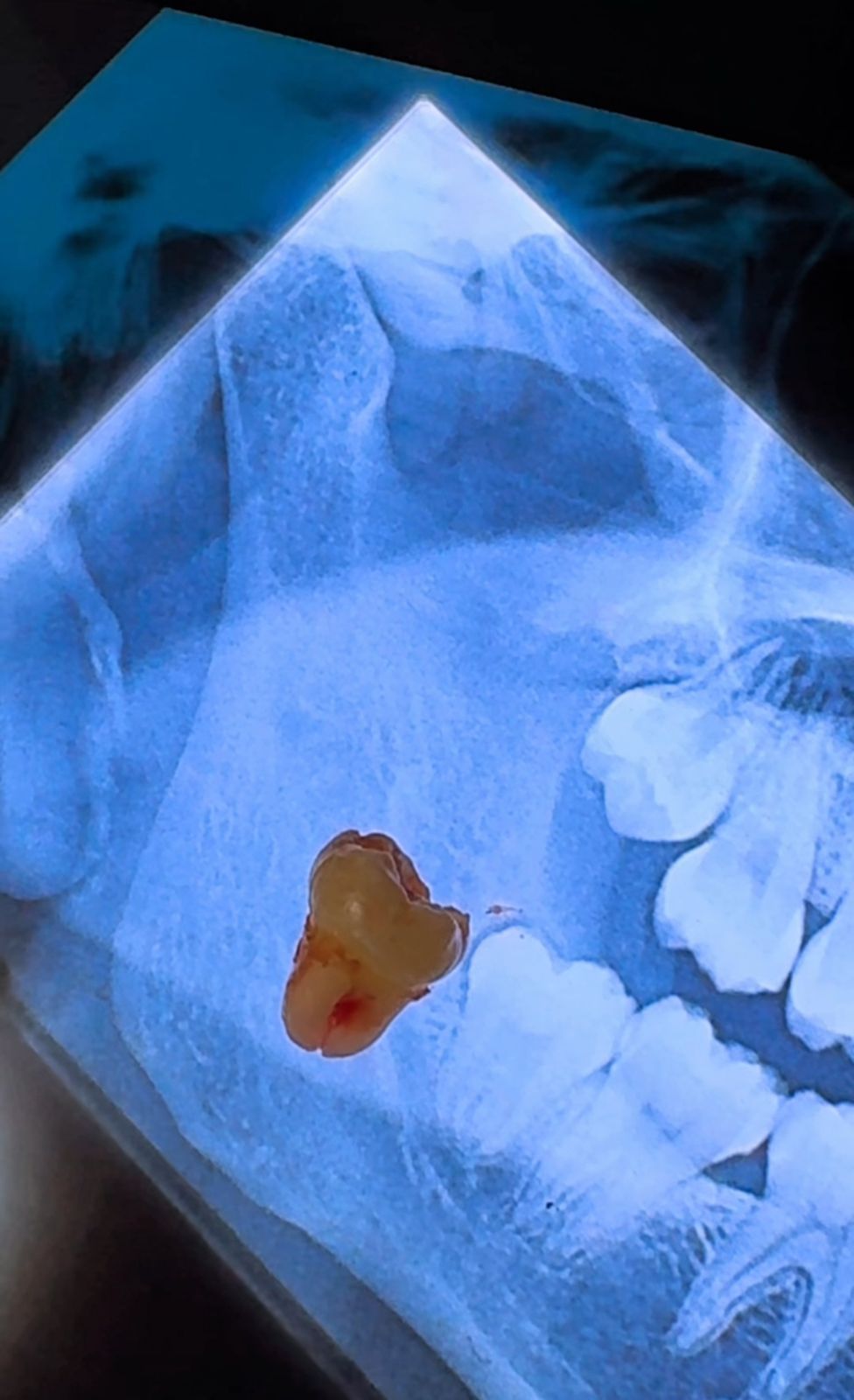 Joel Anderson Valverde Rebaza-2