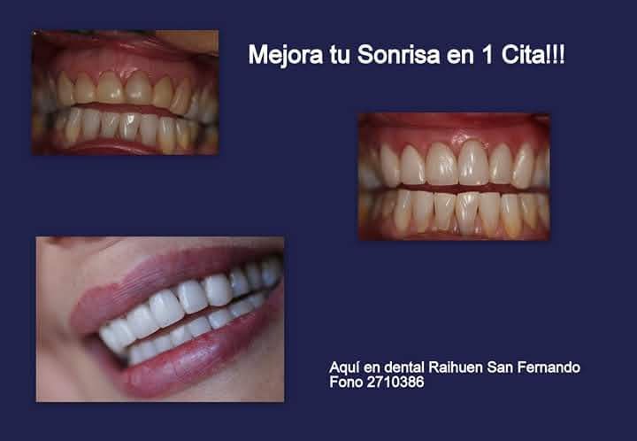 Rodrigo Adolfo Pailamilla Munoz-0