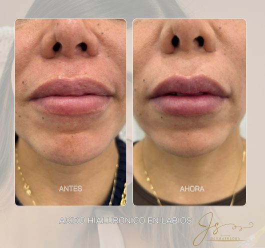 Jasiel Sarai Salas Gomez-3