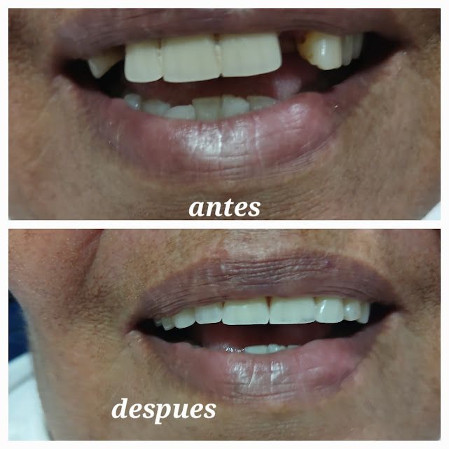 Rodolfo Nelson Olivo Gutierrez-6