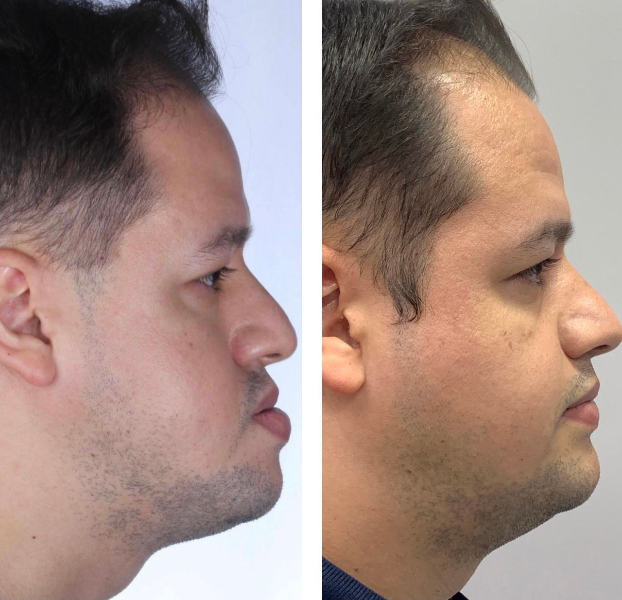 Daniel Assunção-14