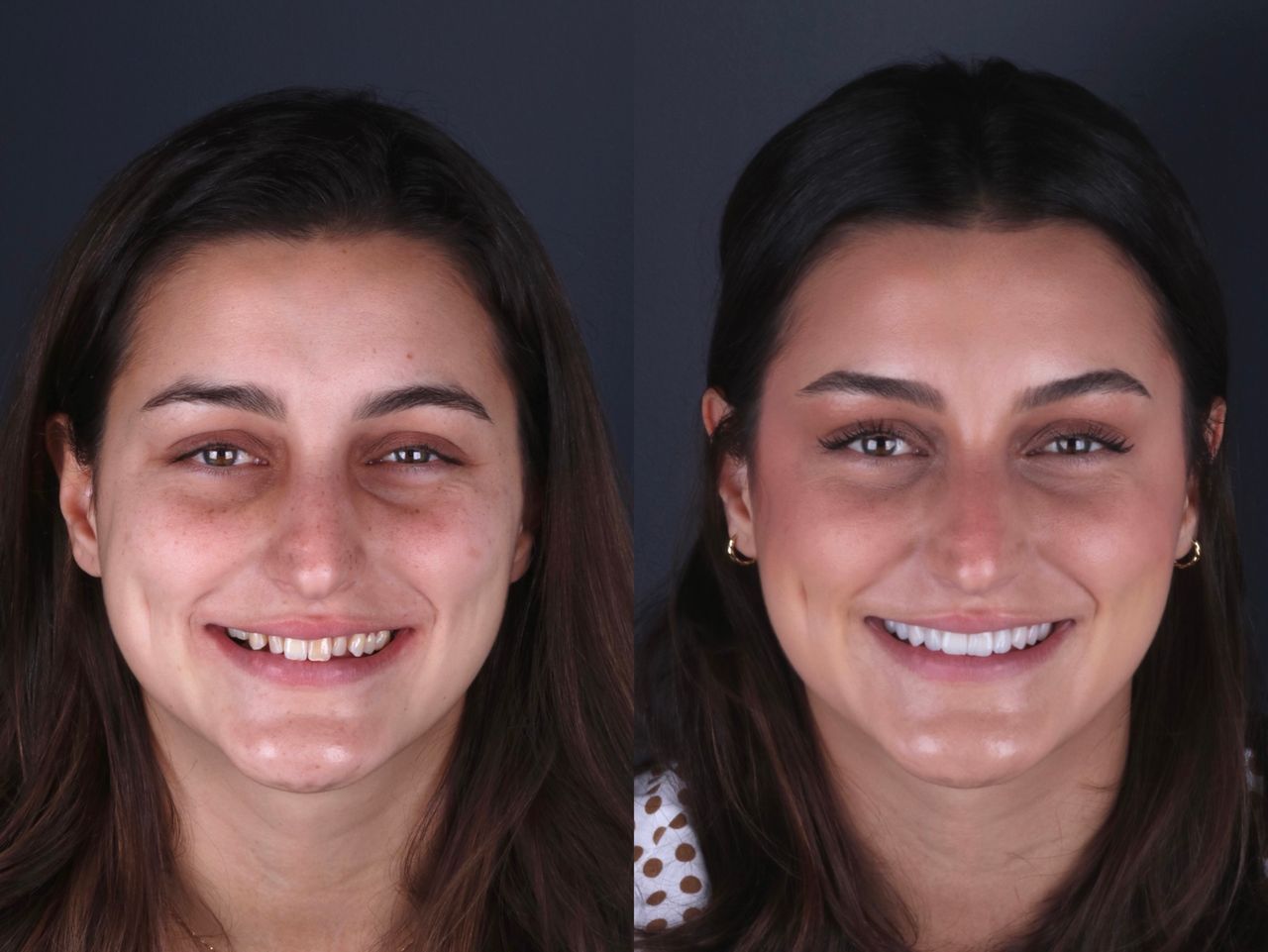 Daniel De Souza Pereira-6