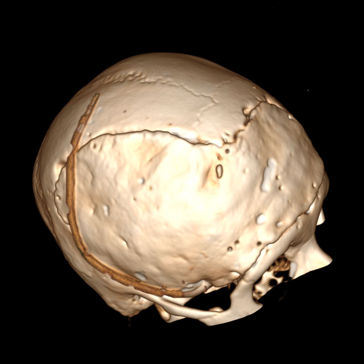 David Tafur Muñoz-1261