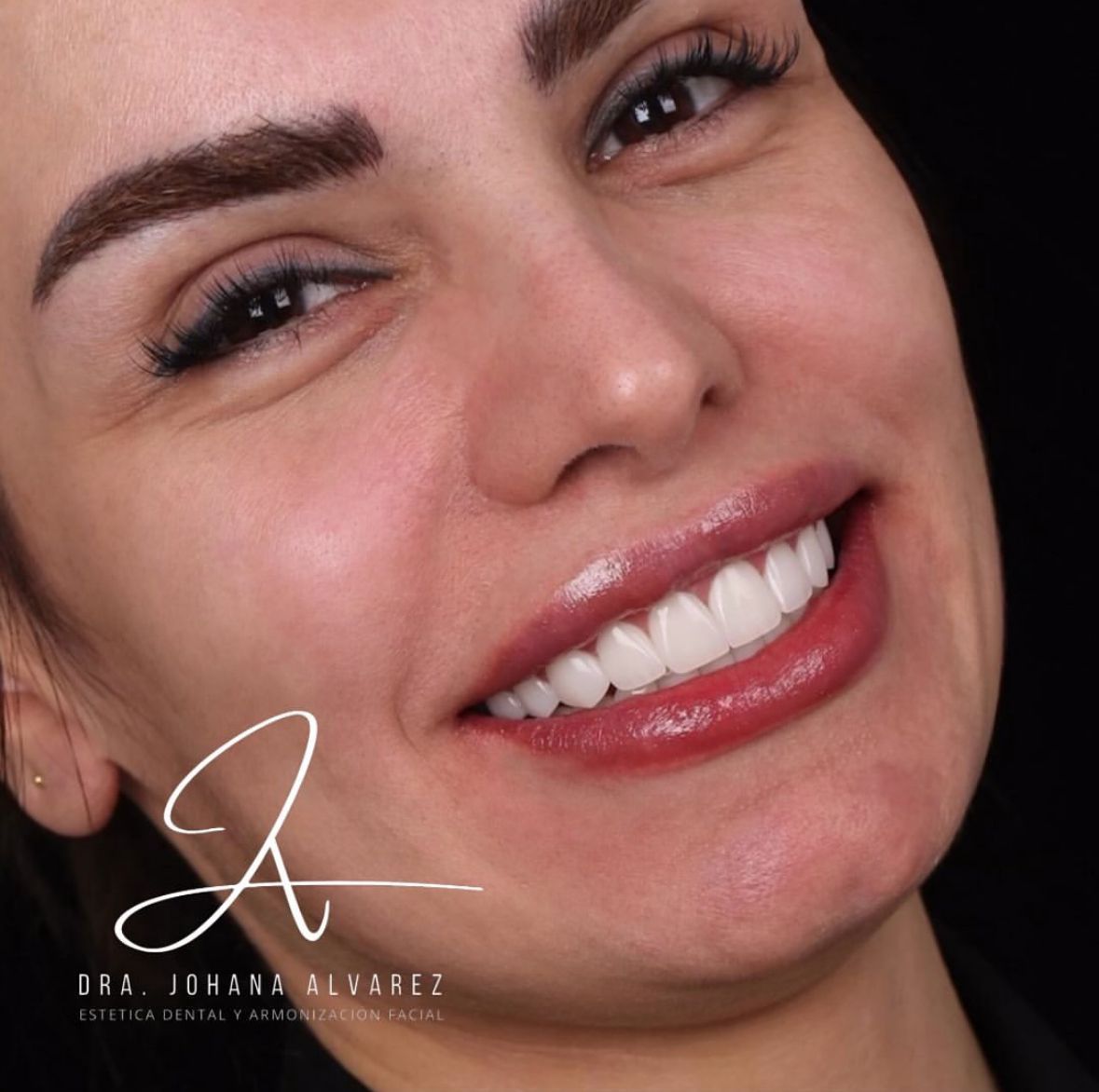 Johana Alvarez Castaño-8