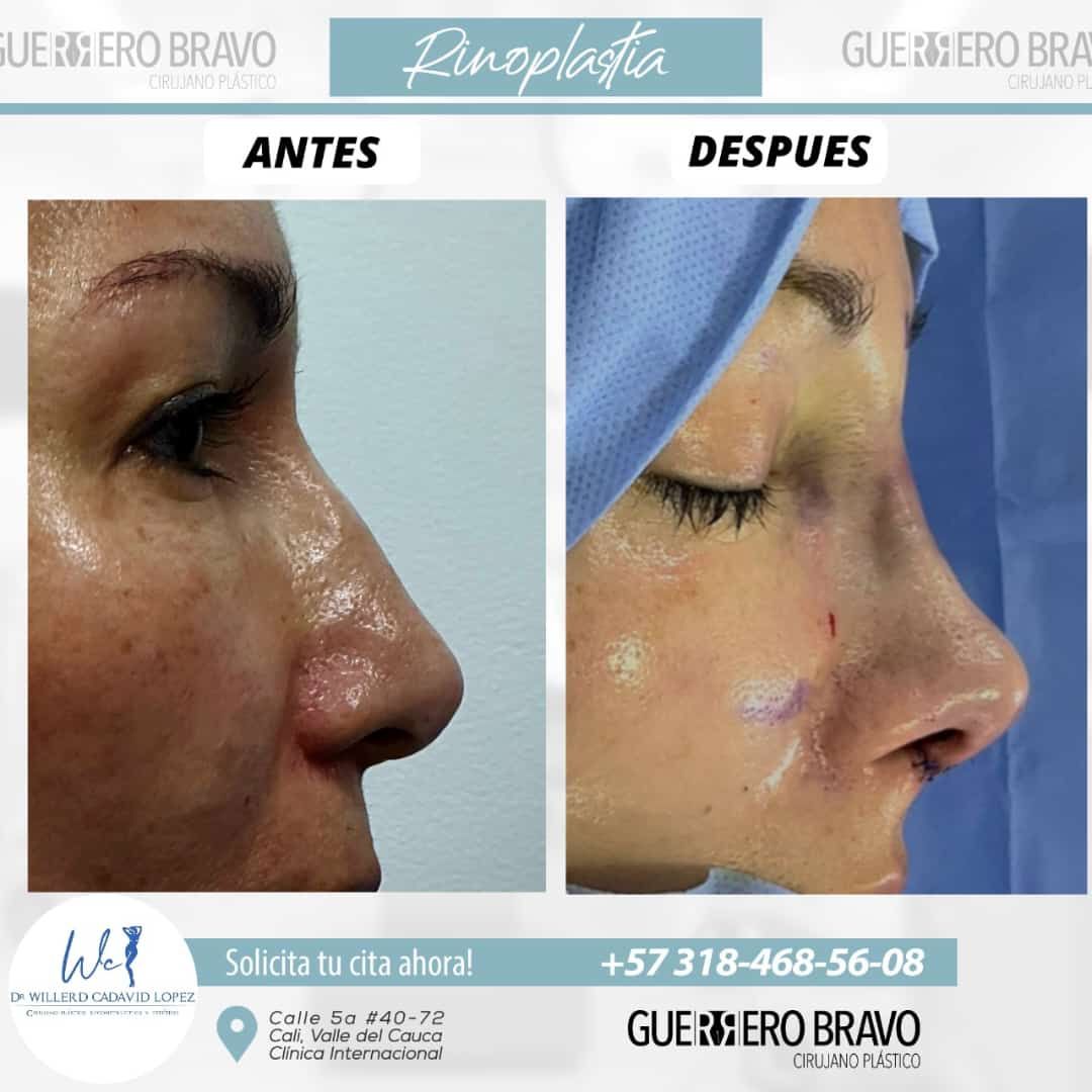 Camilo Guerrero Bravo-33