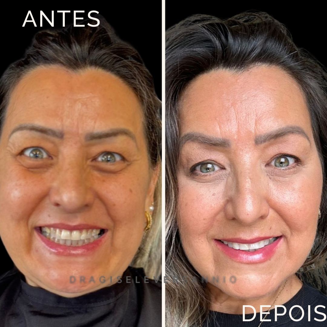 Gisele De Carvalho Versannio-41