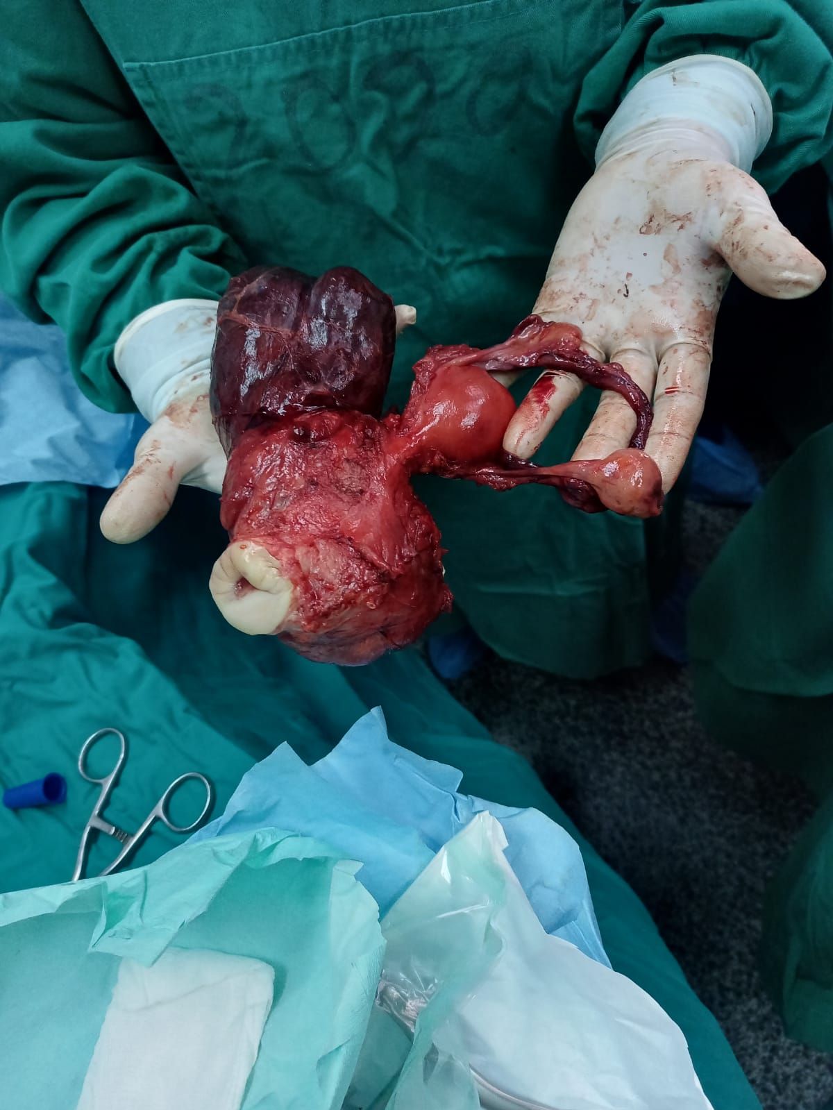 Carla  Lozada Lozada-1