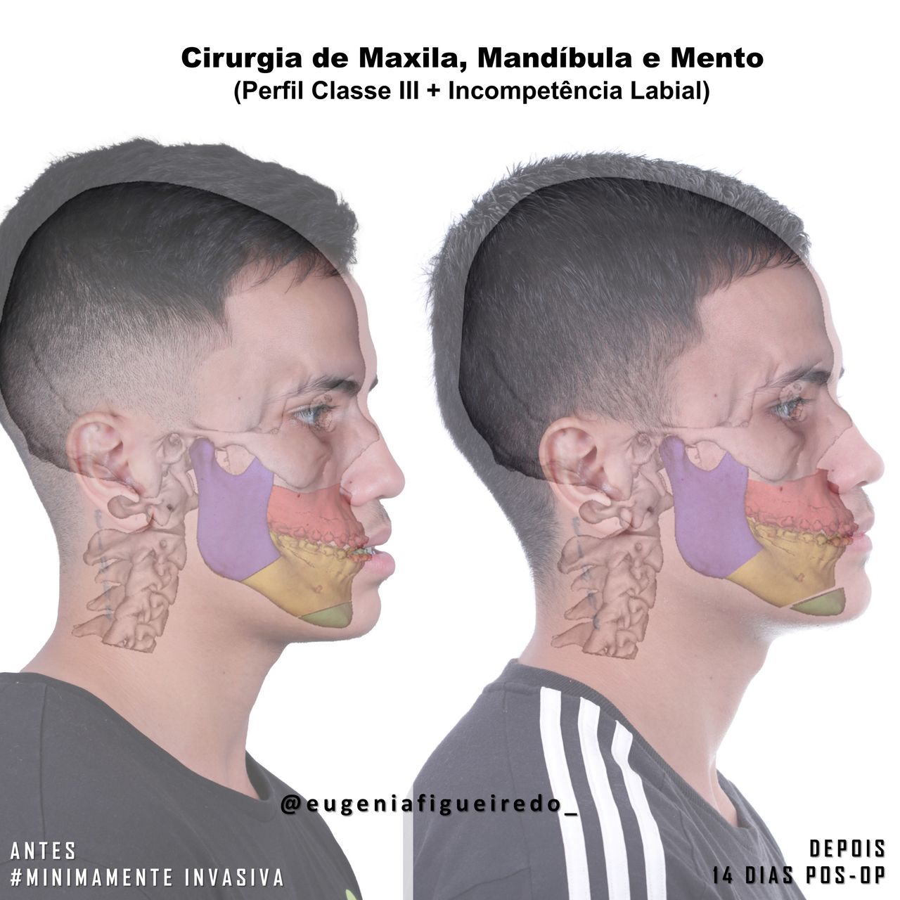 Eugênia Figueiredo-11