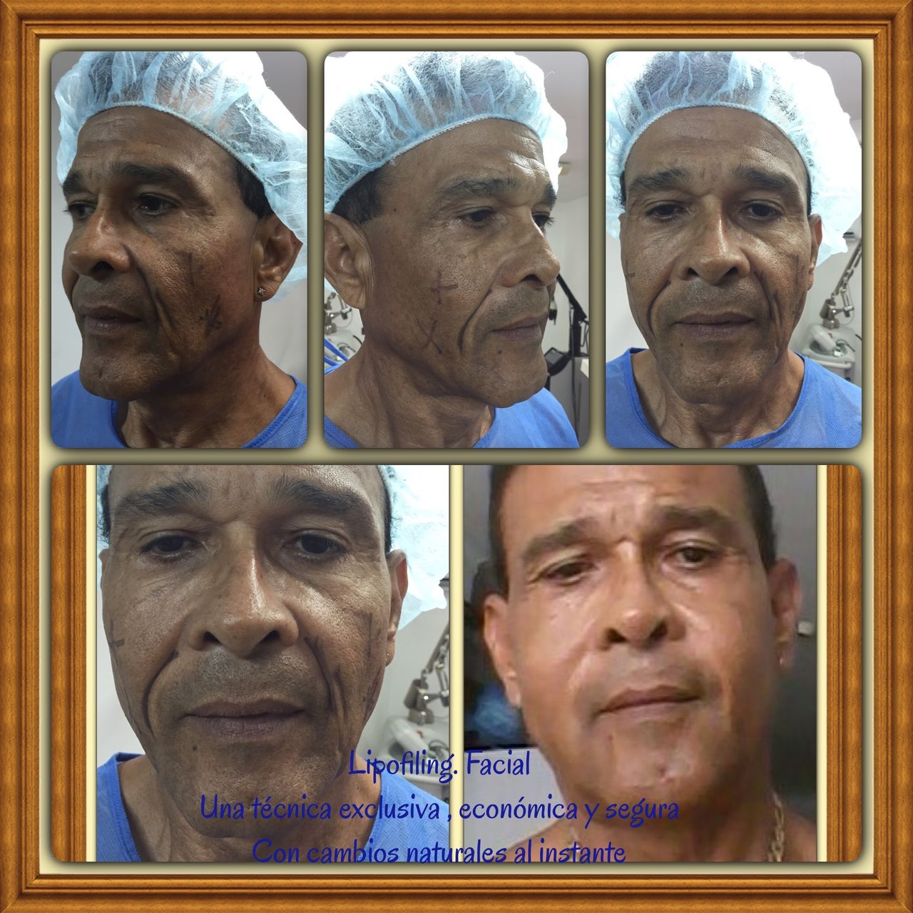 Armando Escobar Juyo-40
