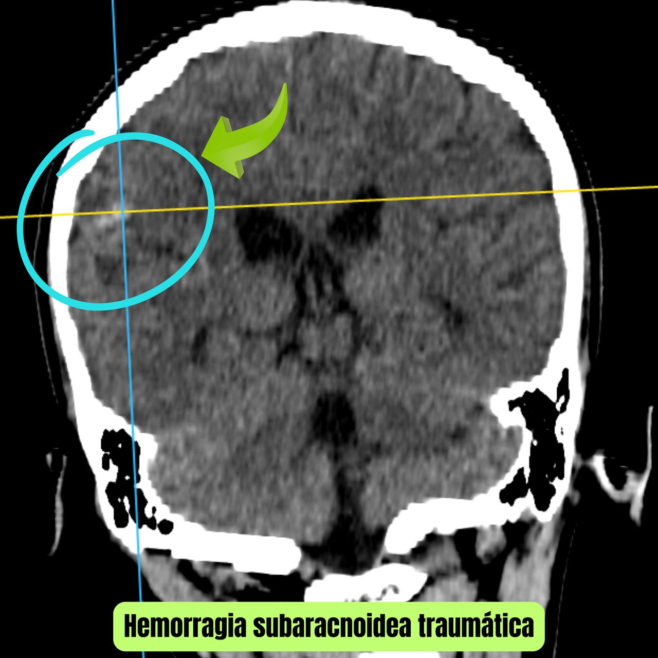 David Tafur Muñoz-1751