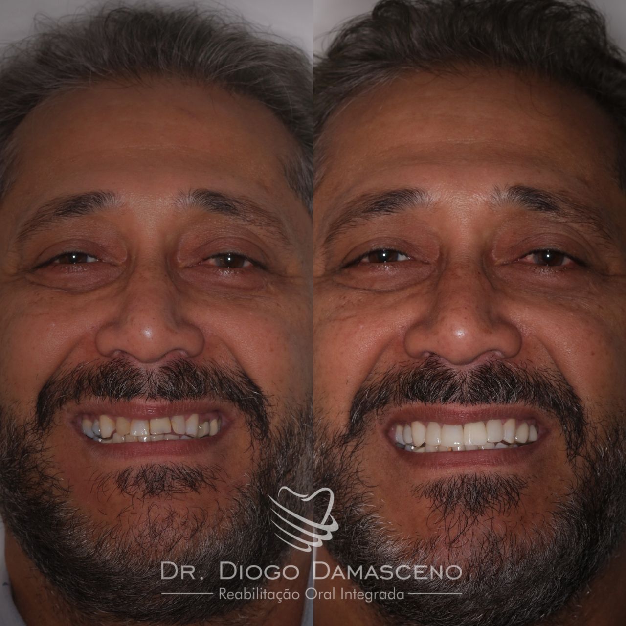 Diogo Damasceno-15