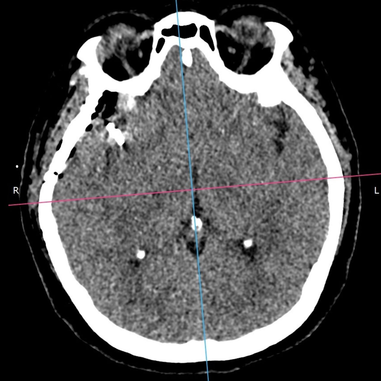 David Tafur Muñoz-1387