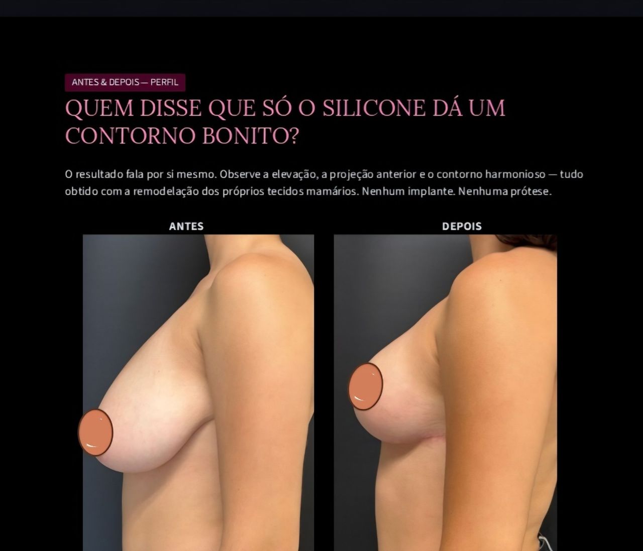 Edvan  Leite-8