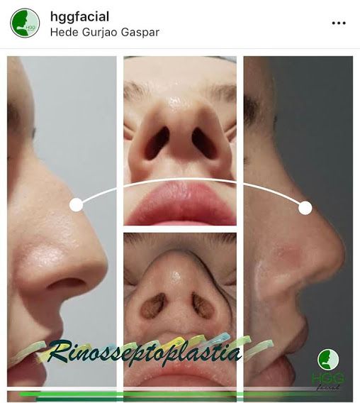 Hede Gurjão Gaspar-1