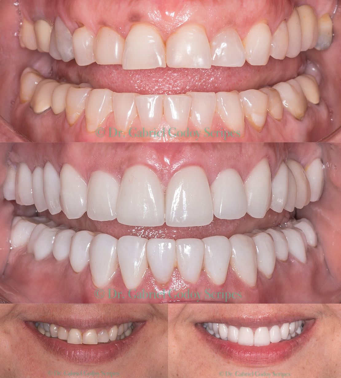 Gabriel Godoy Scripes-84