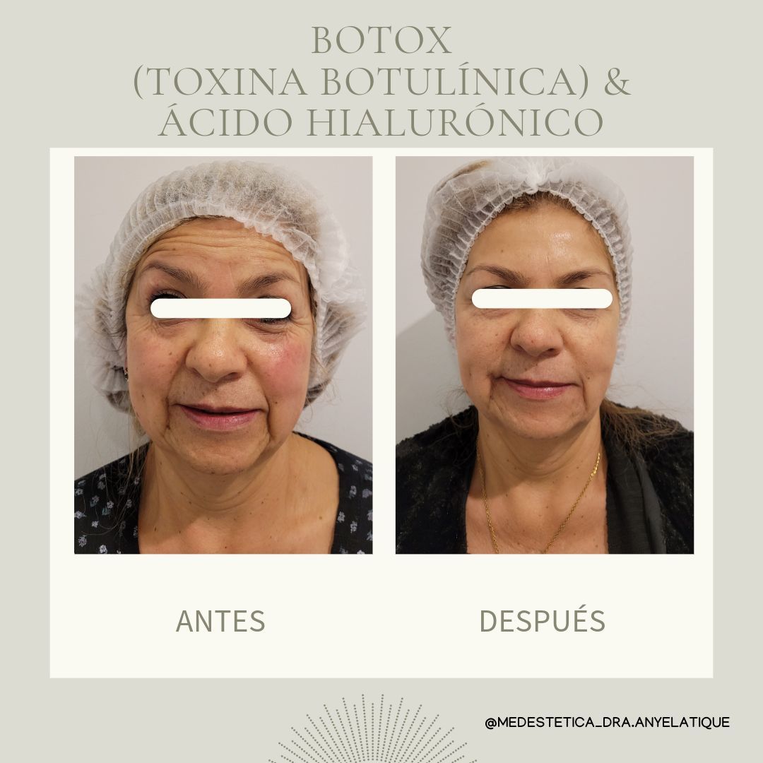 Anyela Tique Hilarión-6