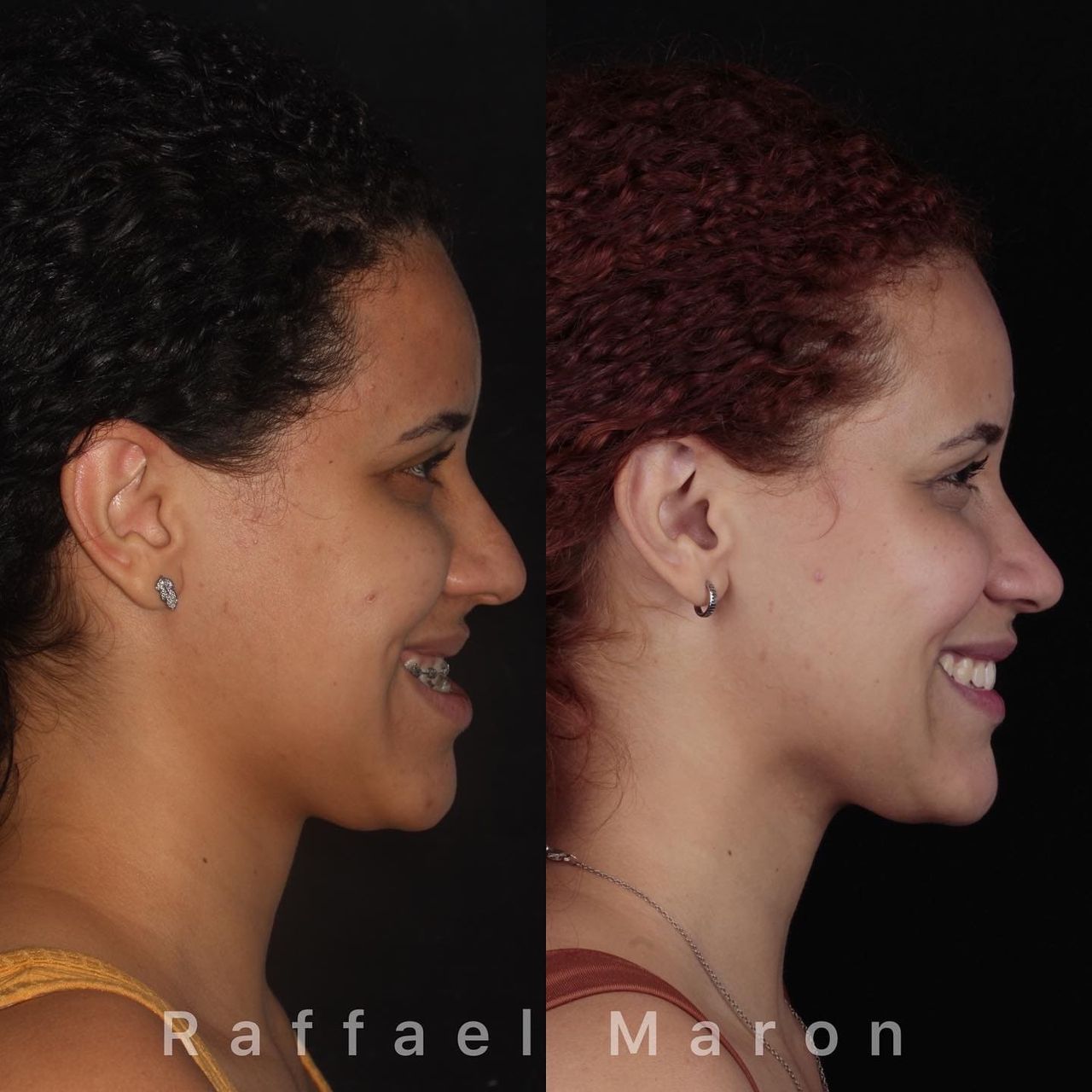 Raffael Maron Vieira De Noronha-17