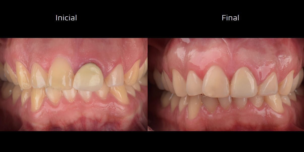 Matías Soto Parra-3