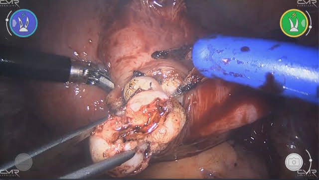 Adalberto Cesario Pereira Junior-35