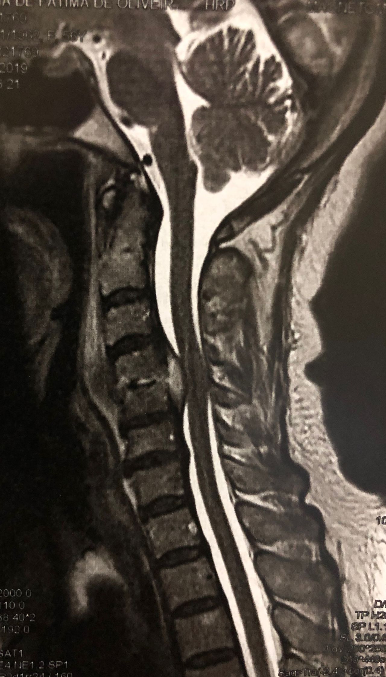 José Lopes Sousa Filho-32