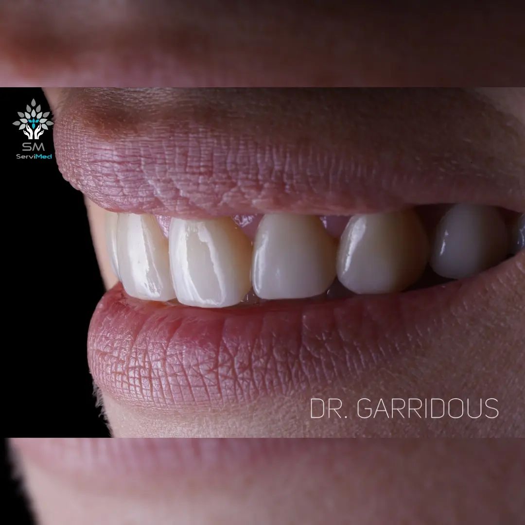 Javier Garrido Tirado-11