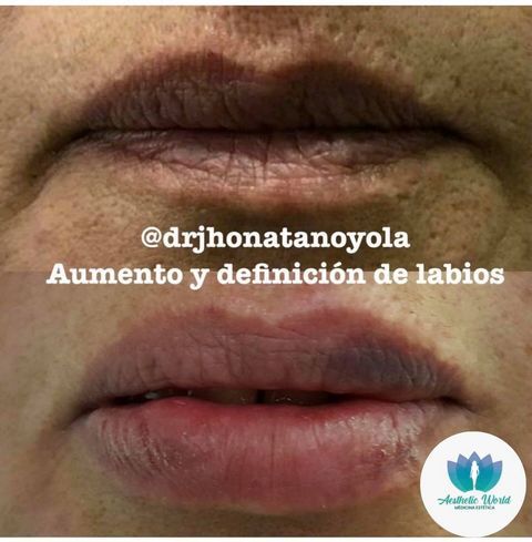 Jhonatan Oyola Farfán-11