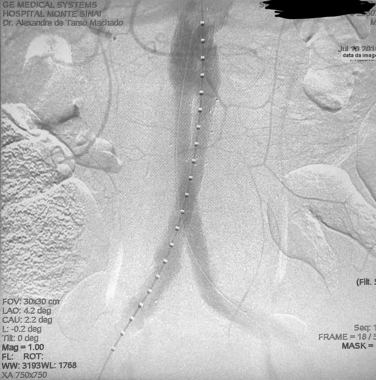 Alexandre De Tarso Machado-12