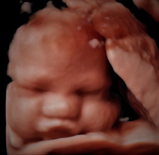 Charles Schwantz De Lima-17