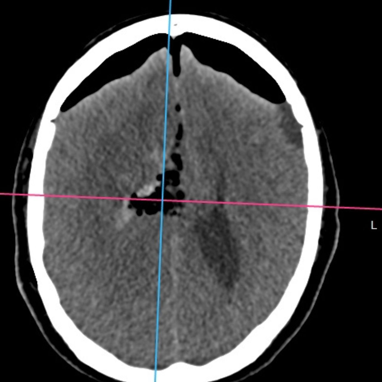 David Tafur Muñoz-1619