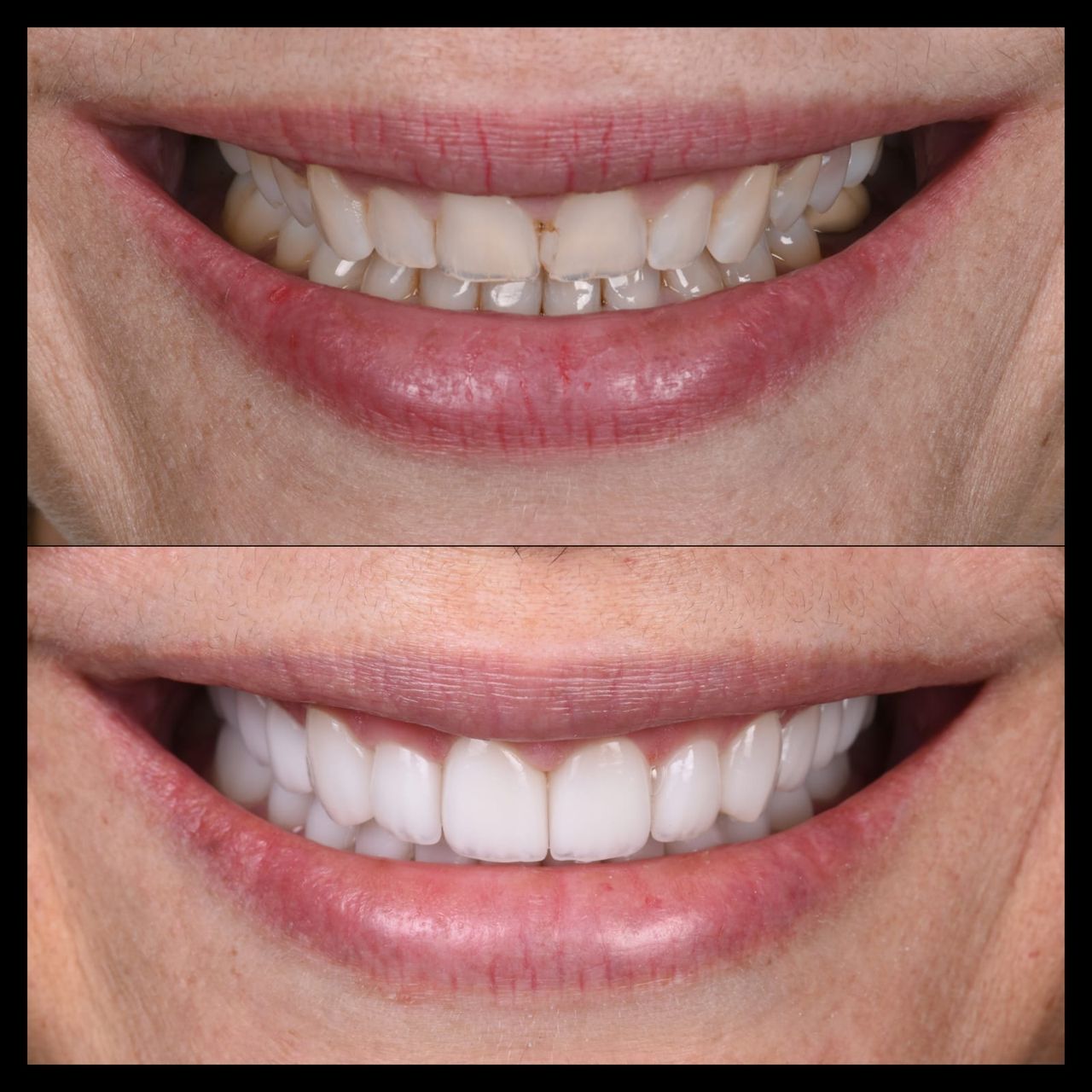 Sharon Andrea Waldo Nicholls-14