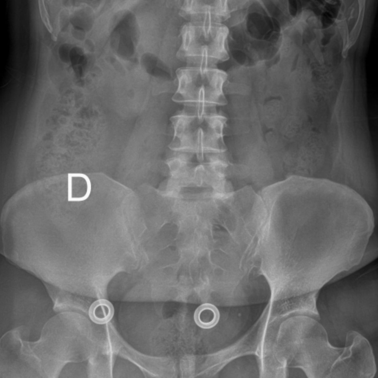 David Tafur Muñoz-2444