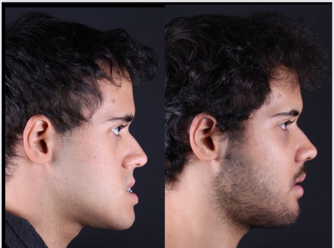 Frederico Carnevale-15