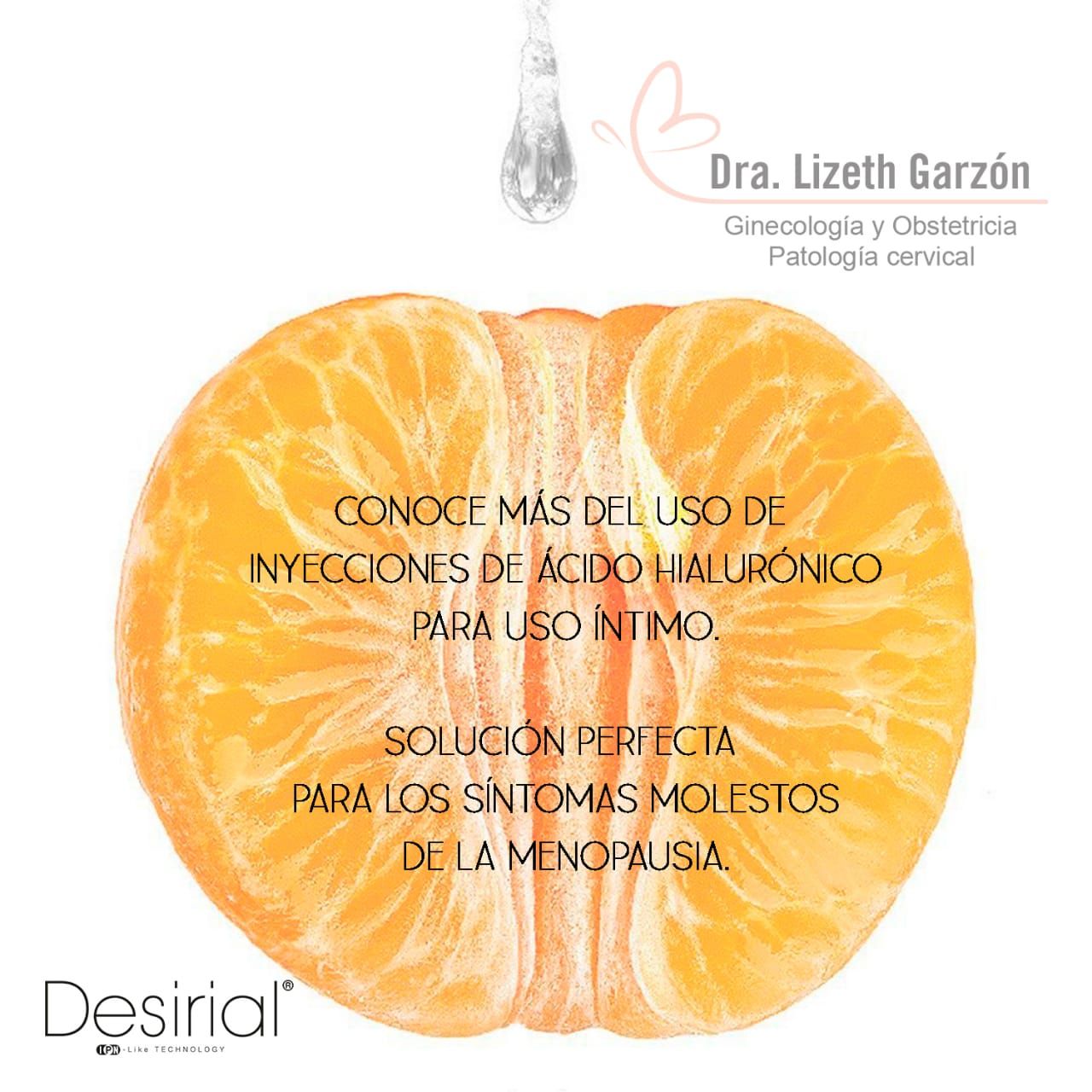 Lizeth Garzon Vargas-11