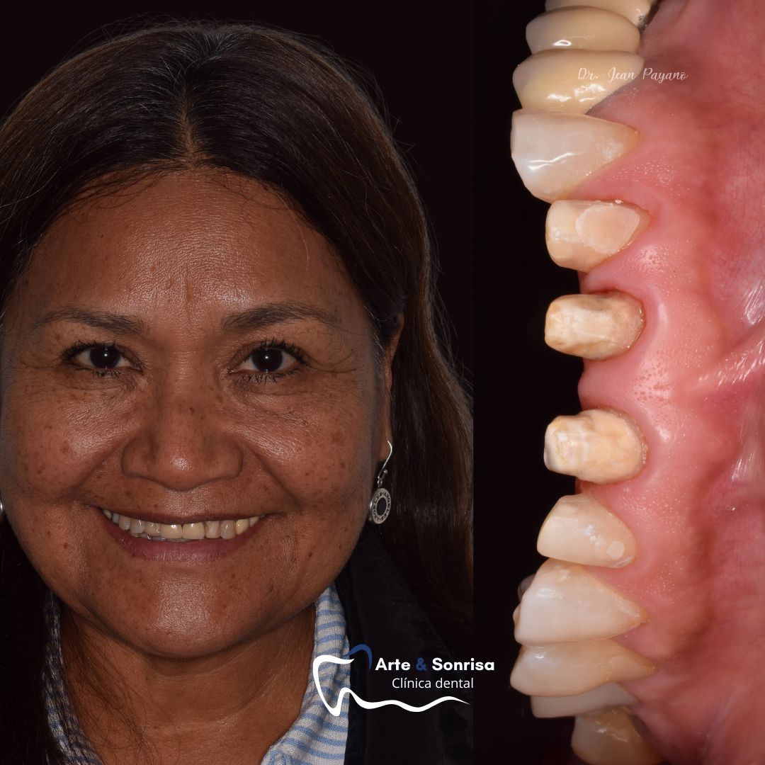 Jean Carlos Payano Arcos-0